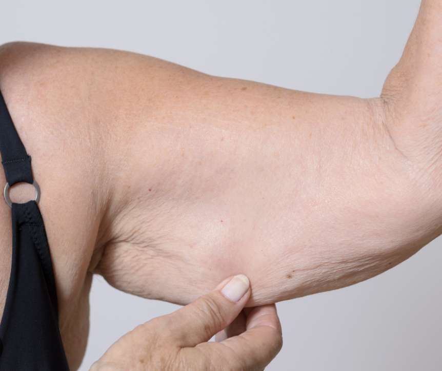 Lassità & Cellulite